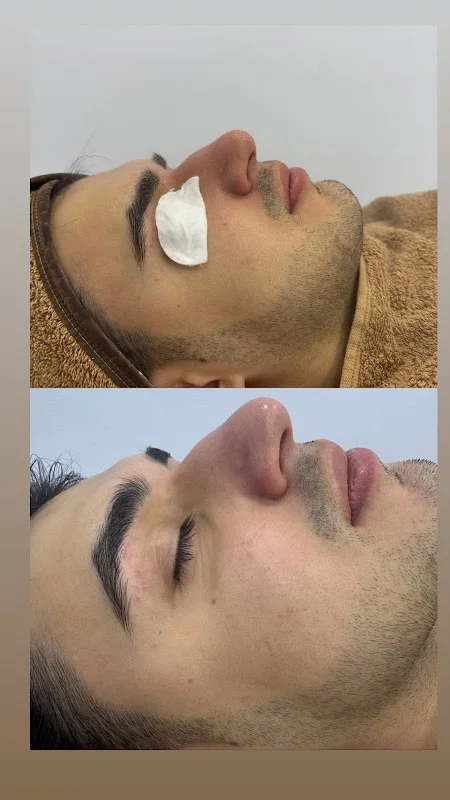 Alebra Beauty - Lazer Epilasyon, Cilt Bakımı, Kirpik Lifting, Kalıcı Makyaj, Manikür Pedikür