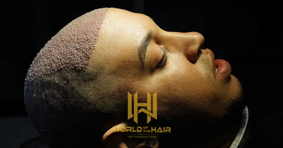 World Of The Hair