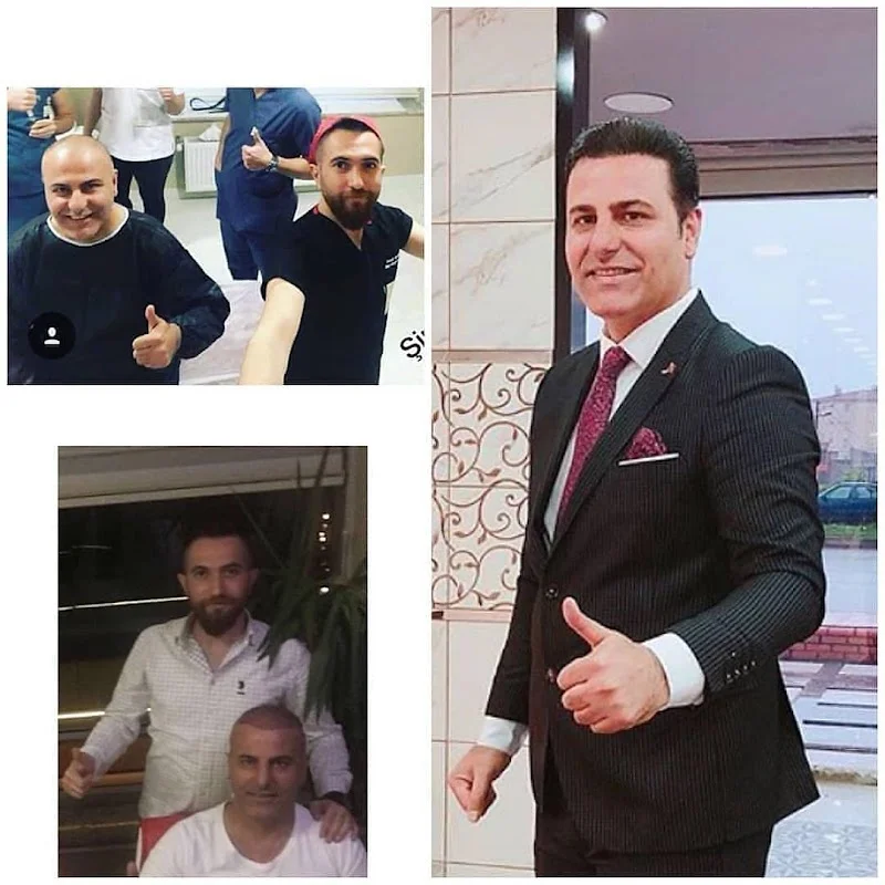 Hair Transplant Center
