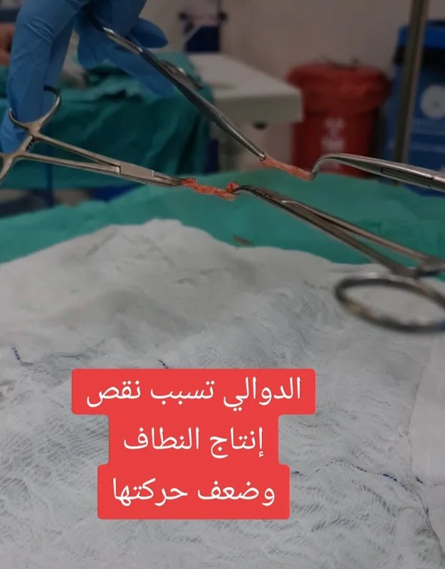 العمليات الجراحية والتجميلية في اسطنبول د. أسامة العبدالله
