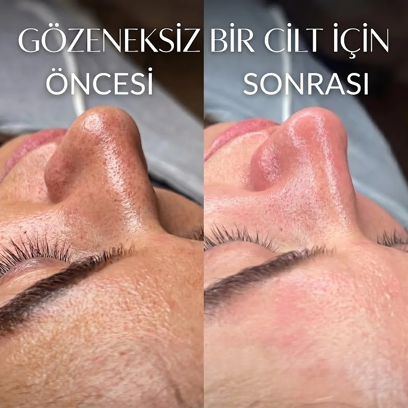 Miray Terapi ve Güzellik Salonu Fatih Buz Lazer Epilasyon, Kirpik Lifting, Meridyen Terapi, Medikal Masaj, Refleksoloji