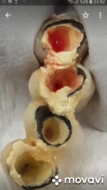 Dentaltermin