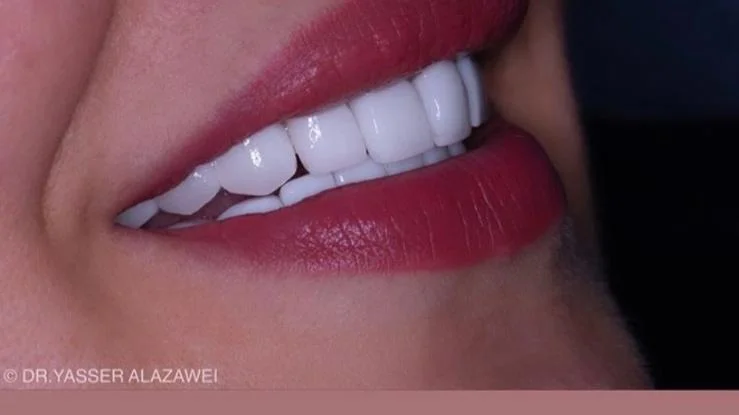 HD Dental Ağız ve Diş Sağlığı Polikliniği | Kadıköy, Bostancı