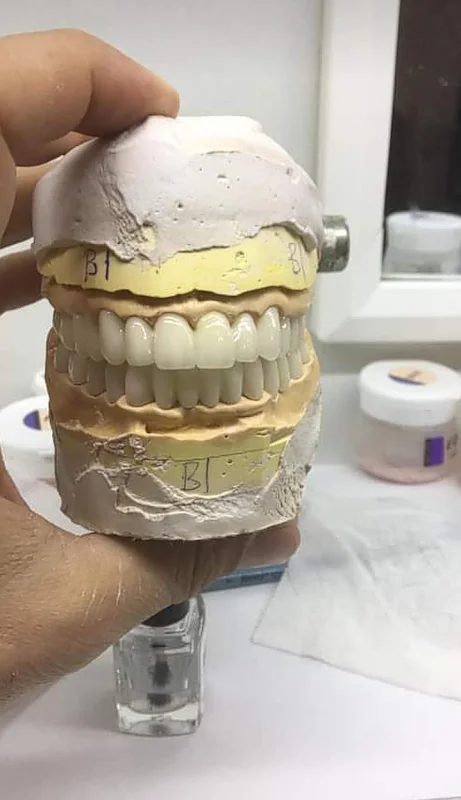 Özel kırıkhanlı ağız ve diş sağlığı kliniği